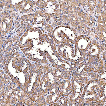 TTLL2 Rabbit Polyclonal Antibody