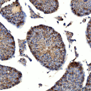 TTLL2 Rabbit Polyclonal Antibody