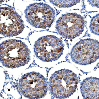 TTLL2 Rabbit Polyclonal Antibody