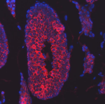 TTLL2 Rabbit Polyclonal Antibody