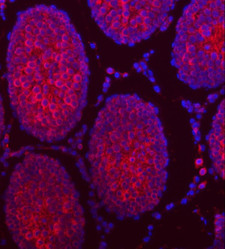 TTLL2 Rabbit Polyclonal Antibody