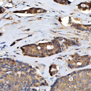 TTLL2 Rabbit Polyclonal Antibody