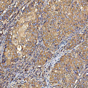 TTLL2 Rabbit Polyclonal Antibody