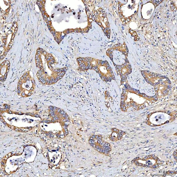 TTLL2 Rabbit Polyclonal Antibody