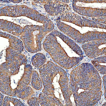 TTLL2 Rabbit Polyclonal Antibody