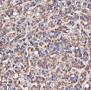 TTLL2 Rabbit Polyclonal Antibody