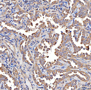 TTLL2 Rabbit Polyclonal Antibody