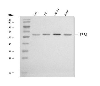 TTI2 Rabbit Polyclonal Antibody