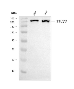TPRBK/TTC28 Rabbit Polyclonal Antibody