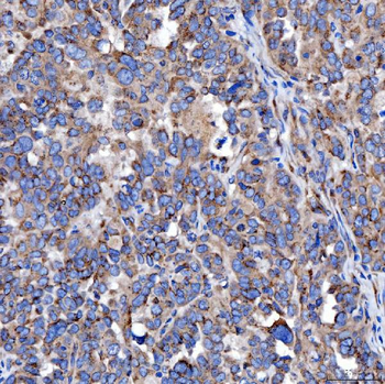 TTC7B Rabbit Polyclonal Antibody