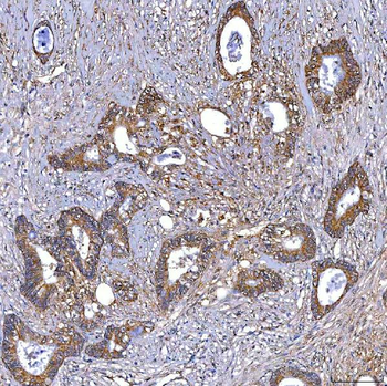 TRMT2B Rabbit Polyclonal Antibody