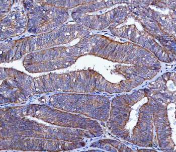 LIN41/TRIM71 Rabbit Polyclonal Antibody