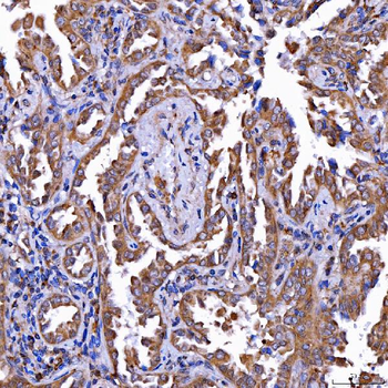 LIN41/TRIM71 Rabbit Polyclonal Antibody