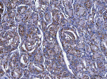 LIN41/TRIM71 Rabbit Polyclonal Antibody