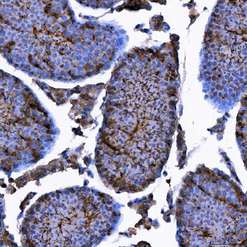 LIN41/TRIM71 Rabbit Polyclonal Antibody
