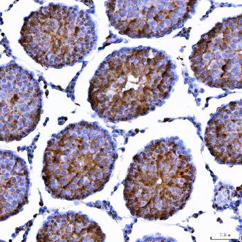 LIN41/TRIM71 Rabbit Polyclonal Antibody