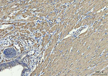 TP53I13 Rabbit Polyclonal Antibody