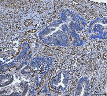 TP53I13 Rabbit Polyclonal Antibody