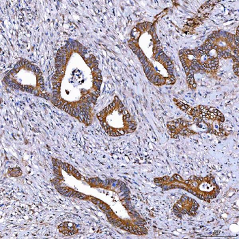 TOMM34 Rabbit Polyclonal Antibody