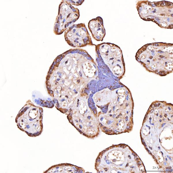 TOMM34 Rabbit Polyclonal Antibody