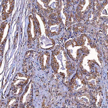 TOMM34 Rabbit Polyclonal Antibody