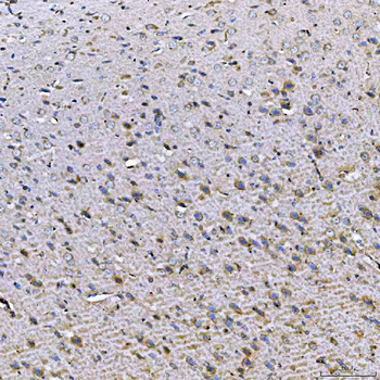 TOM1L1 Rabbit Polyclonal Antibody