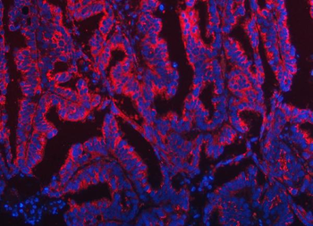 TOM1L1 Rabbit Polyclonal Antibody