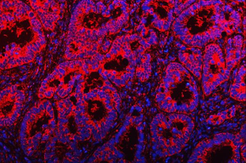 TOM1L1 Rabbit Polyclonal Antibody