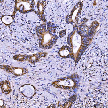 TOM1L1 Rabbit Polyclonal Antibody