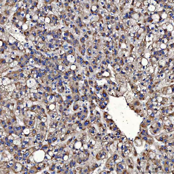 TOM1L1 Rabbit Polyclonal Antibody