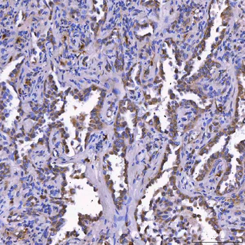 TOM1L1 Rabbit Polyclonal Antibody