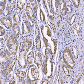 TOM1L1 Rabbit Polyclonal Antibody