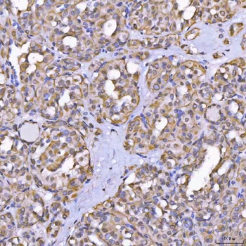 TOM1L1 Rabbit Polyclonal Antibody
