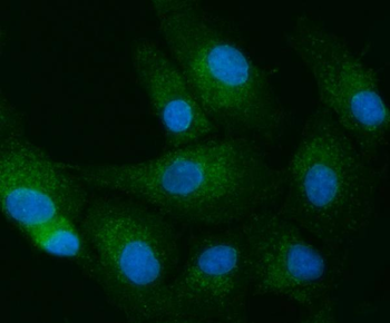 TOLLIP Rabbit Polyclonal Antibody