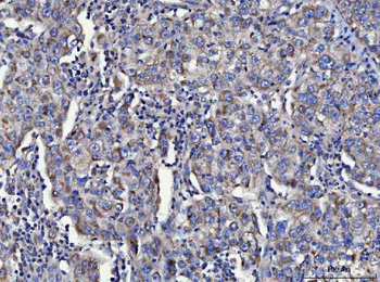 TOLLIP Rabbit Polyclonal Antibody