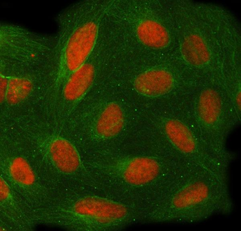 TOE1 Rabbit Polyclonal Antibody