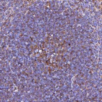 LIGHT/Tnfsf14 Rabbit Polyclonal Antibody