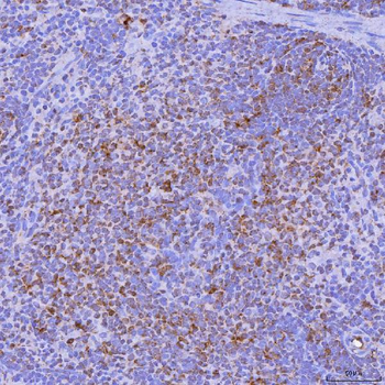 LIGHT/Tnfsf14 Rabbit Polyclonal Antibody