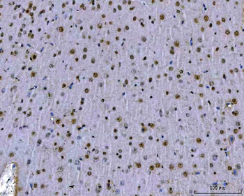 SFPQ Rabbit Polyclonal Antibody