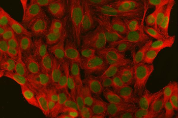 SFPQ Rabbit Polyclonal Antibody