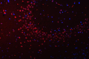 SFPQ Rabbit Polyclonal Antibody