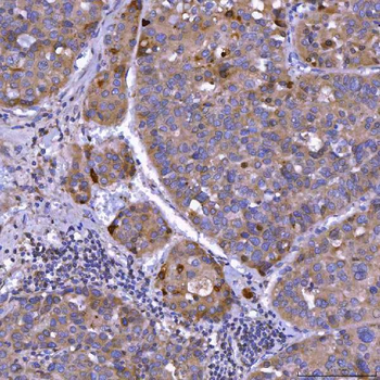 Septin 11/SEPTIN11 Rabbit Polyclonal Antibody