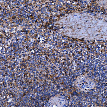 Septin 11/SEPTIN11 Rabbit Polyclonal Antibody