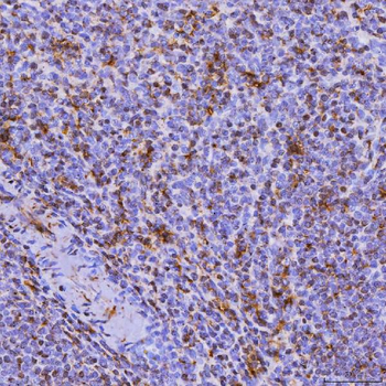 SEPT6/SEPTIN6 Rabbit Polyclonal Antibody