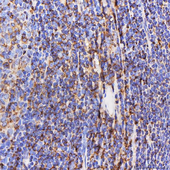 SEPT6/SEPTIN6 Rabbit Polyclonal Antibody