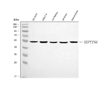 SEPT6/SEPTIN6 Rabbit Polyclonal Antibody