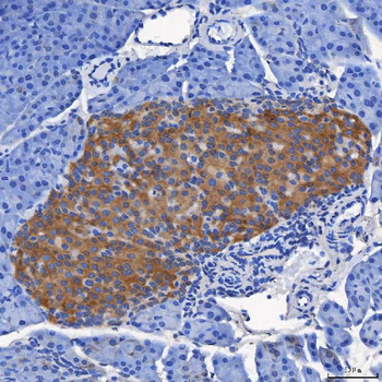 SEL1L Rabbit Polyclonal Antibody