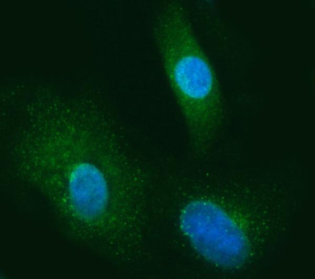 SEC13L1/SEC13 Rabbit Polyclonal Antibody