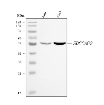 ENTR1 Rabbit Polyclonal Antibody