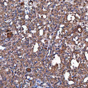 SCO1 Rabbit Polyclonal Antibody